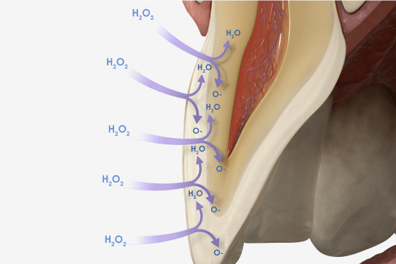 Image of whitening example